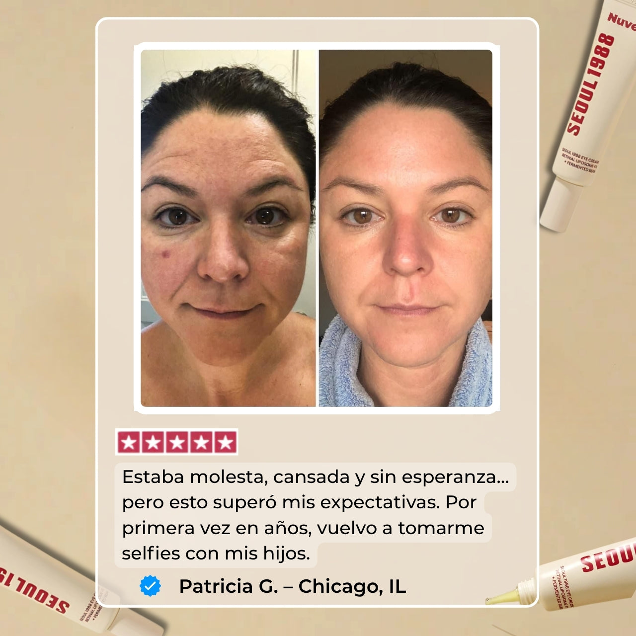 Nuvee | Retinal 4 % Liposomado Tratamiento