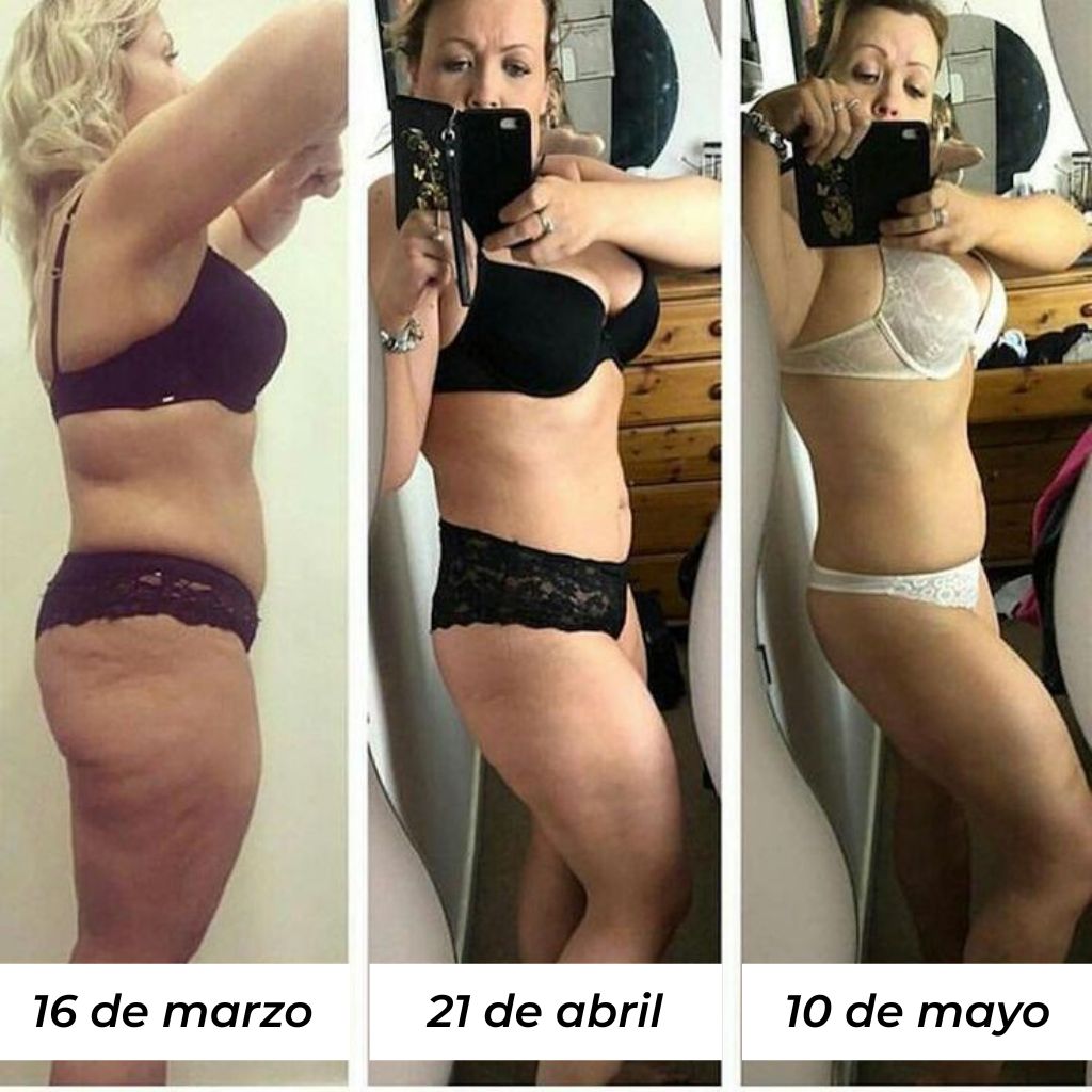 Nuvée | Masajeador Anti-Celulitis para Piernas