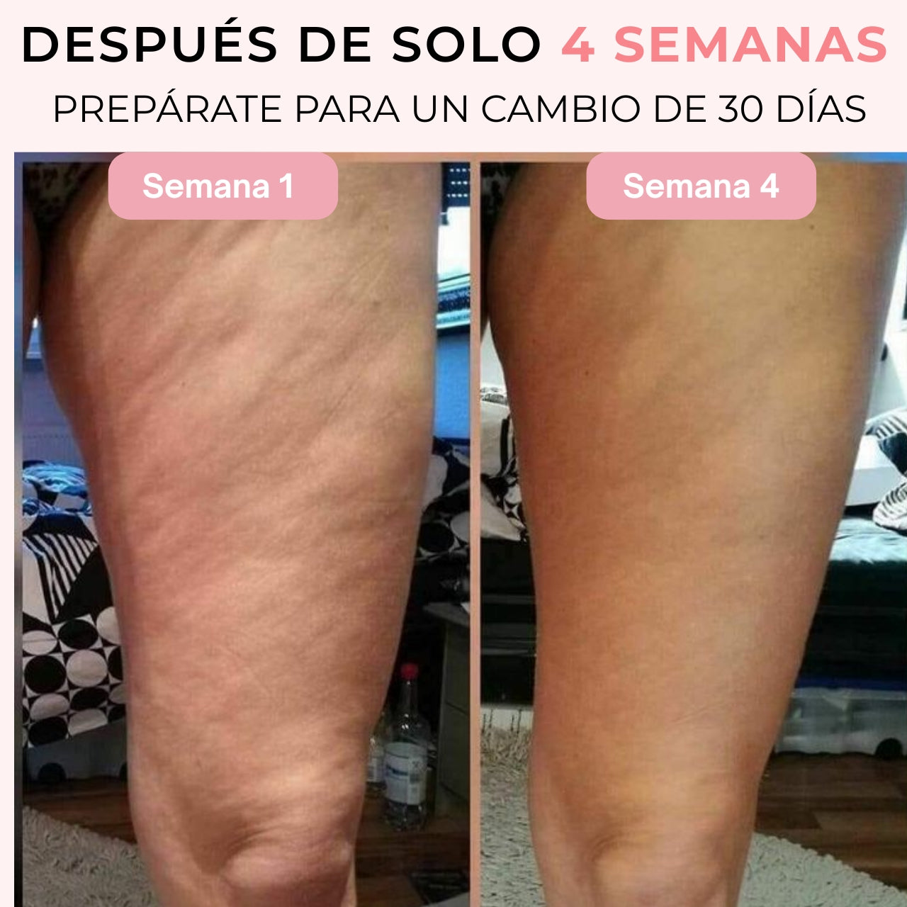 Nuvée | Masajeador Anti-Celulitis para Piernas